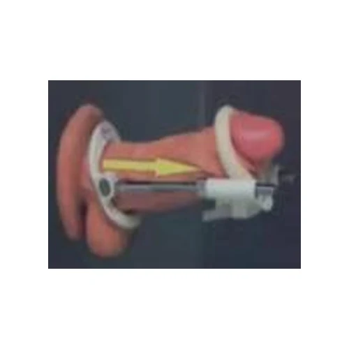 Alargador Extensor de Pene Sistema Elongador dorado